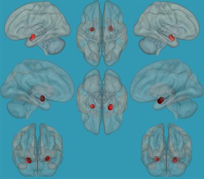 Decreased Functional Connectivity Between the Left Amygdala and Frontal Regions Interferes With Reading, Emotional, and Executive Functions in Children With Reading Difficulties